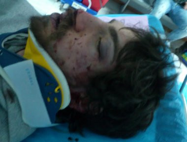 Σοκάρουν οι φωτό από τον άγριο ξυλοδαρμό του φοιτητή - ΕΛ.ΑΣ: «Όλα δείχνουν ότι στόχος των δραστών ήταν το σακίδιο»